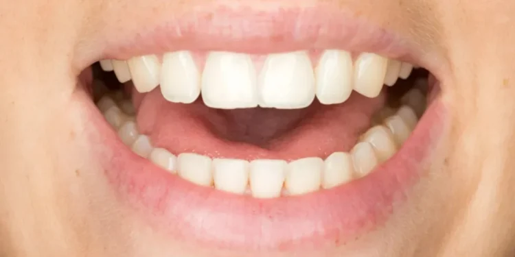 Causa da gagueira é multifatorial, o que significa que ela é resultado de uma combinação fatores como genéticos e neurológicos • 4FR/Getty Images