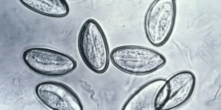 "Detox de vermes" vira tendência e médica alerta para os riscos  • CDC via CNN Newsource