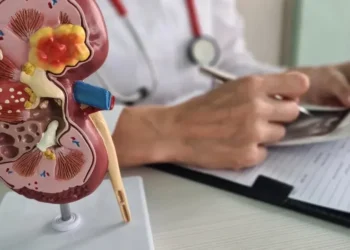 Câncer renal deve crescer nos próximos anos, diz OMS  • Nadzeya Haroshka/GettyImages