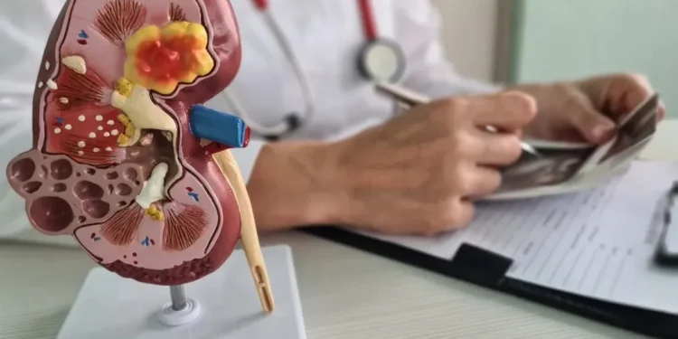 Câncer renal deve crescer nos próximos anos, diz OMS  • Nadzeya Haroshka/GettyImages