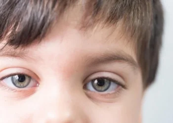 A leucocoria é um sinal, não um diagnóstico. Ela não salva só o olho, mas a vida dessas crianças crédito: Freepik