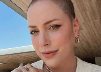 Fabiana Justus diz que fez transplante pelo SUS: “Dinheiro não comprou”