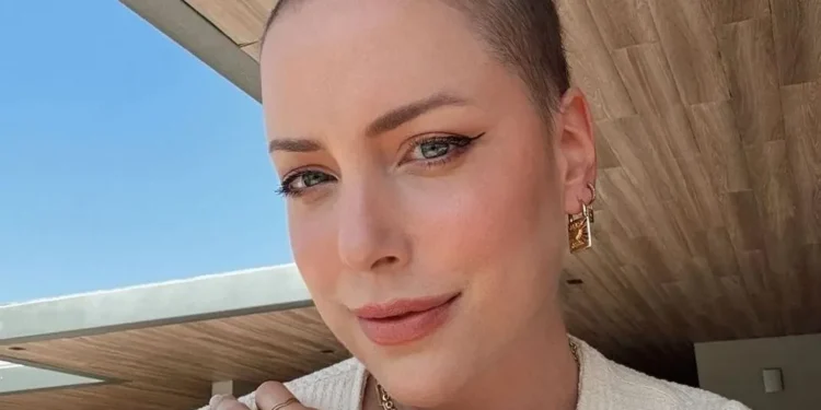 Fabiana Justus diz que fez transplante pelo SUS: “Dinheiro não comprou”