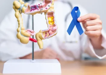 Câncer colorretal pode ser mais agressivo em jovens, diz estudo