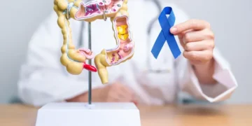 Câncer colorretal • Getty Images