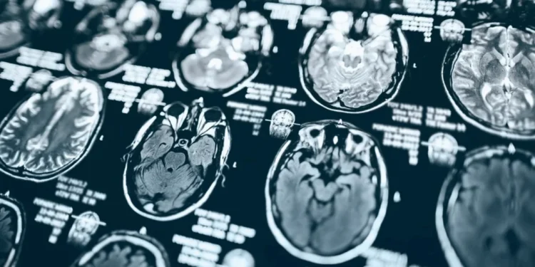 Popartic/Getty Images