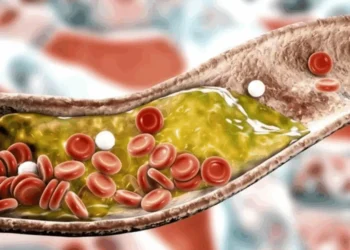 Nova diretriz da SBC estabelece limites mais rígidos para colesterol