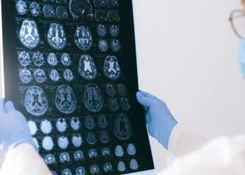 Entenda as promessas do medicamento recém-aprovado para câncer cerebral