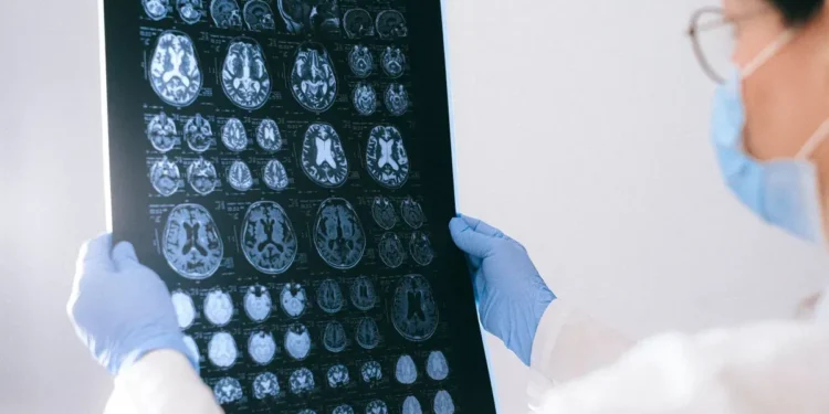 Entenda as promessas do medicamento recém-aprovado para câncer cerebral
