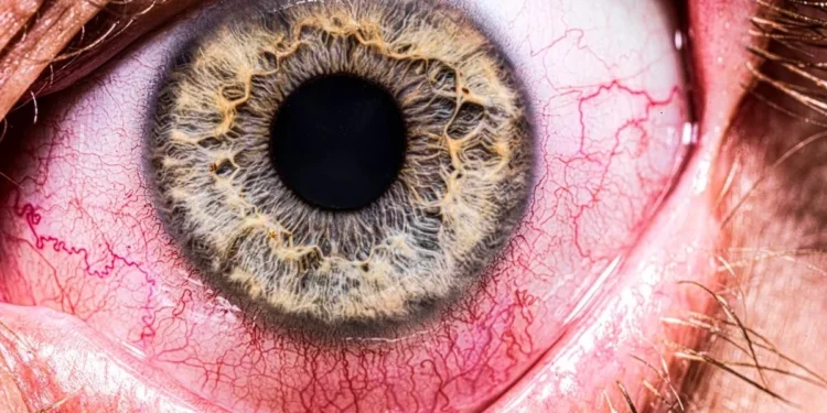 Foto: Jonathan Knowles / Getty Images