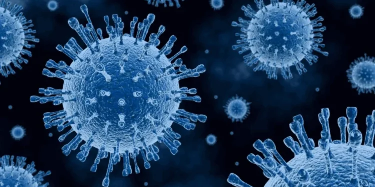 Olena_T/Getty Images