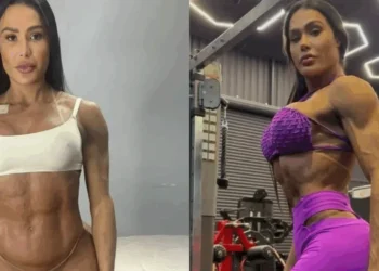 Gracyanne explica ganho de 20 kg após cirurgia: “Tomei um susto”