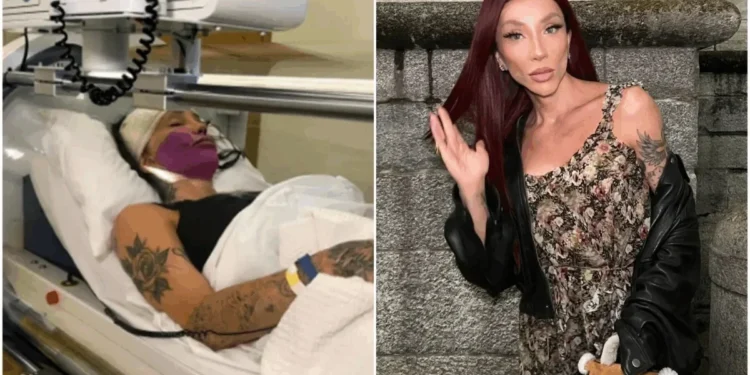 Maya Massafera tira ossos do maxilar em nova cirurgia