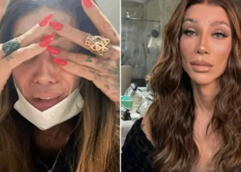 Maya Massafera tem complicações após nova cirurgia no rosto