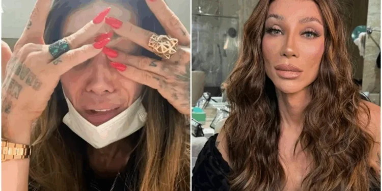 Maya Massafera tem complicações após nova cirurgia no rosto