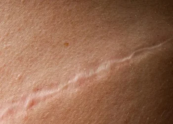 Foto: WIN-Initiative / Neleman / Getty Images