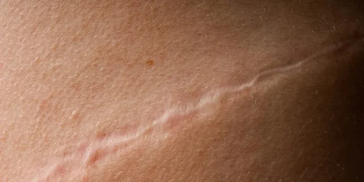 Foto: WIN-Initiative / Neleman / Getty Images