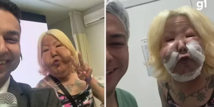 Veja antes e depois da primeira cirurgia de Juliana — Foto: Reprodução/Redes sociais @drmarra