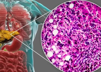 Foto: KATERYNA KON/ Getty Images