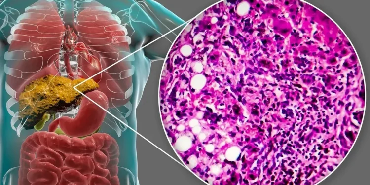 Foto: KATERYNA KON/ Getty Images