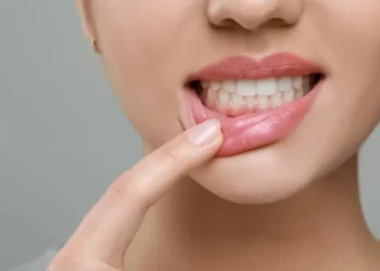 Foto: Liudmila Chernetska/ Getty Images