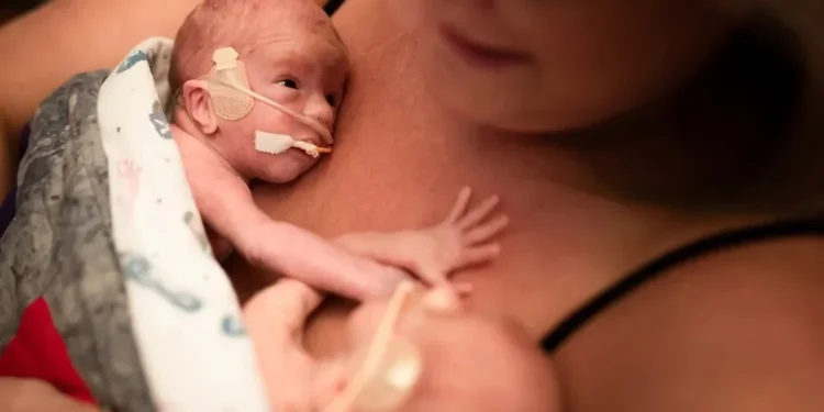 Foto: Jill Lehmann Photography / Getty Images