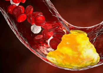 KATERYNA KON/SCIENCE PHOTO LIBRARY/Getty Images