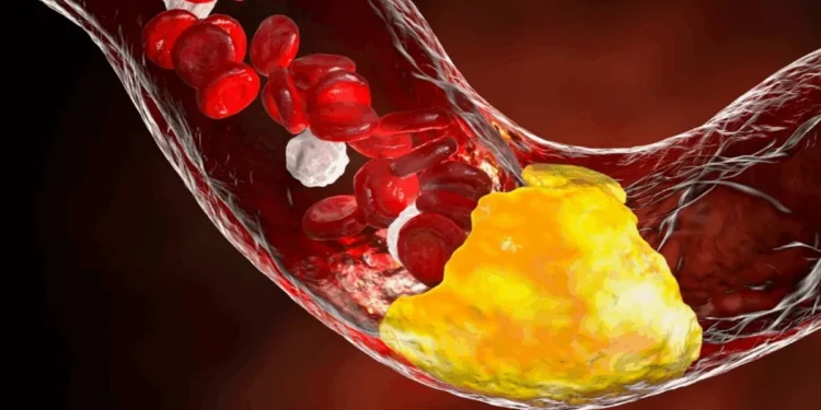 KATERYNA KON/SCIENCE PHOTO LIBRARY/Getty Images