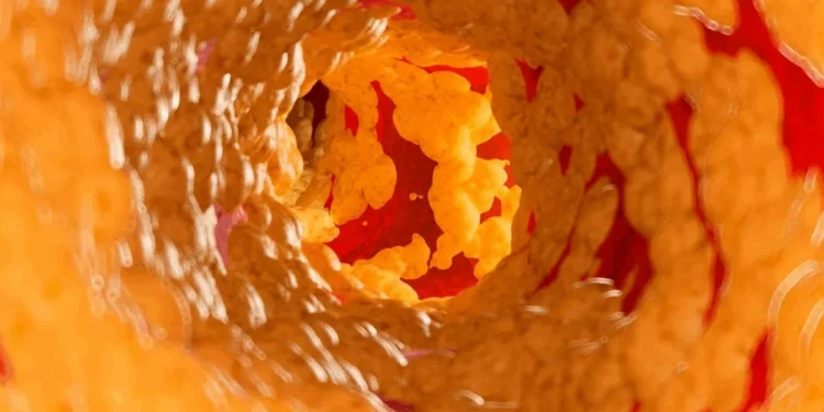 SCIEPRO/SCIENCE PHOTO LIBRARY/Getty Images