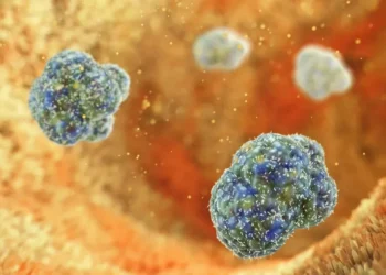 Alllex / Getty Images