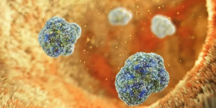 Alllex / Getty Images