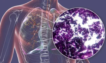 Kateryna Kon / Getty Images