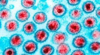 Callista Images/Gettyimages