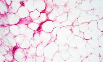 tonaquatic/Getty Images