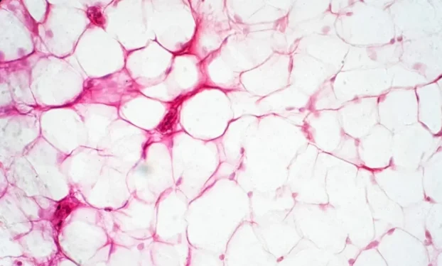 tonaquatic/Getty Images