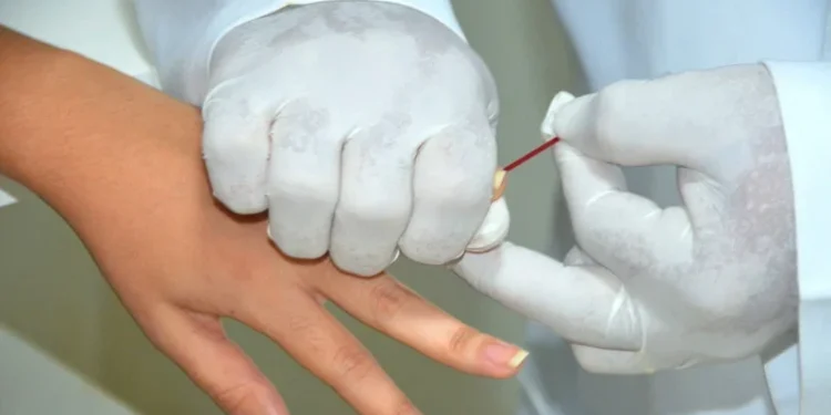 Em 2025, foram distribuídos no Tocantins, 31.922 testes de HIV; 24.825 testes Duo Sífilis-HIV; e 25.450 testes de sífilis