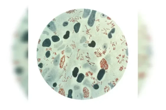 Foto: Reprodução/CDC