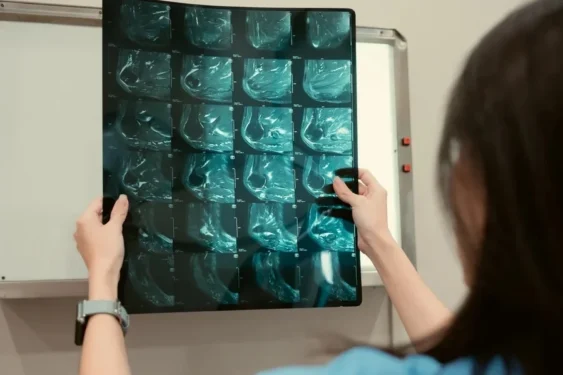 Foto: Sunan Wongsa-nga / Getty Images