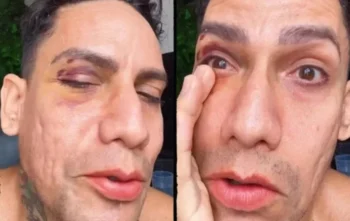 Reprodução/ Redes Sociais