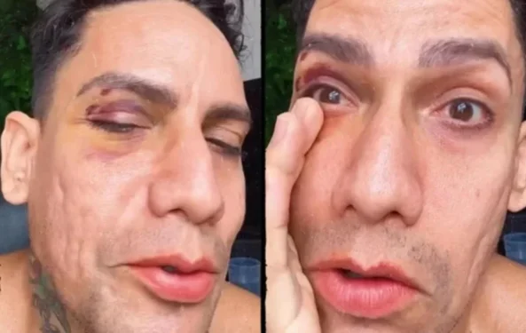 Reprodução/ Redes Sociais