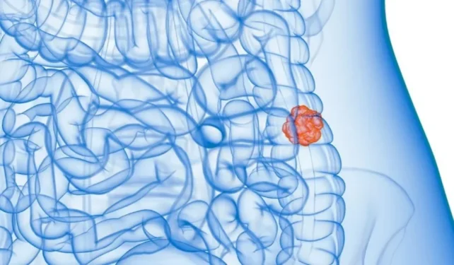 Sebastian Kaulitzki/Science Photo Library/Gettyimages