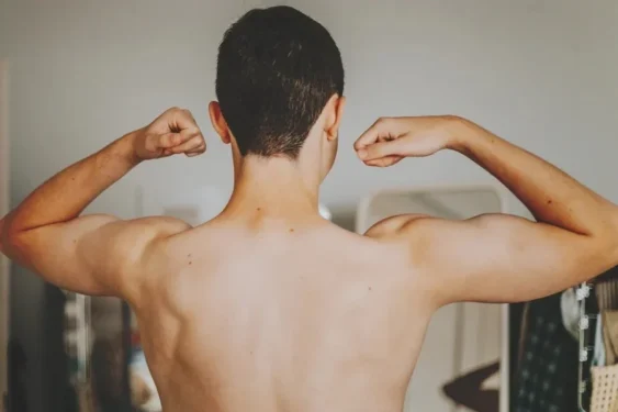 Foto:Carol Yepes / Getty images