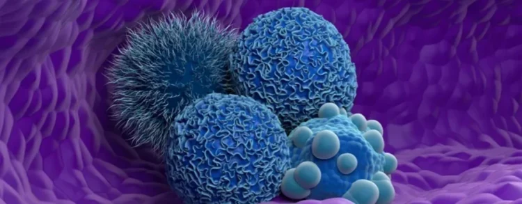 Nemes Laszlo/Science Photo Library/Gettyimages