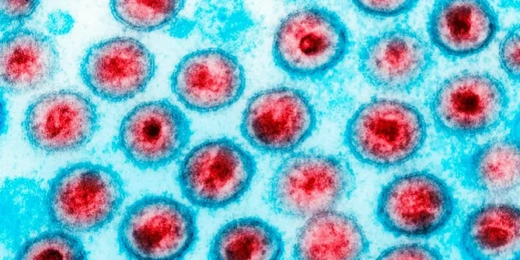 Callista Images/Gettyimages