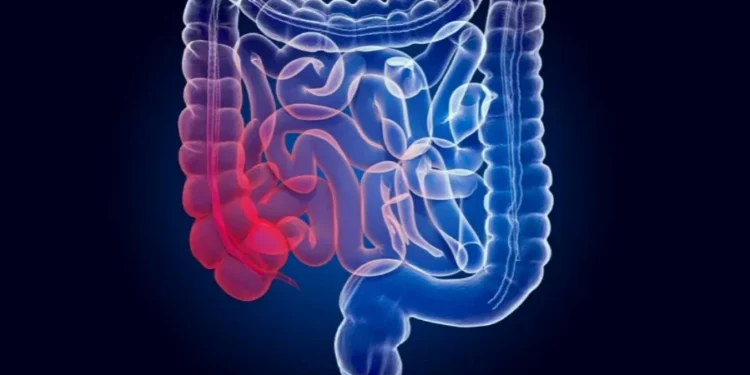 AlexLMX/Getty Images