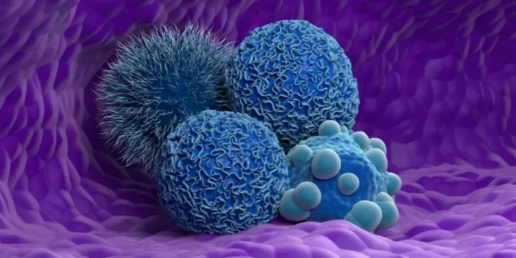 Nemes Laszlo/Science Photo Library/Gettyimages