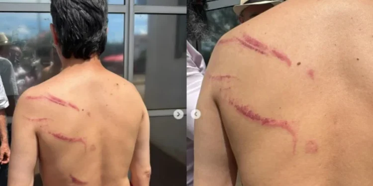 Reprodução/Redes sociais