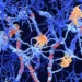 Juan Gaertner/Science Photo Library/Getty Images