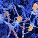 Juan Gaertner/Science Photo Library/Getty Images