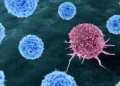 Thom Leach/Science Photo Library/Getty Images